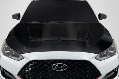 Carbon Creations J Speed Hood Compatible With 2019-23 Hyundai Veloster - 1 Piece - 117052