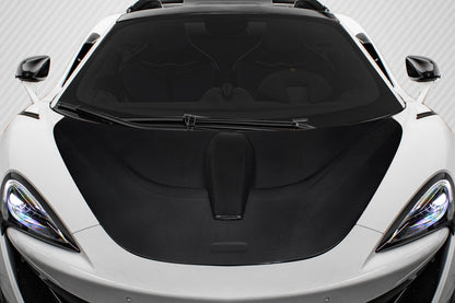 Carbon Creations Boost Hood Compabitble With 2016-2020 McLaren 570S - 1 Piece - 119288